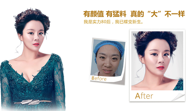 果洛脂肪移植、隆鼻