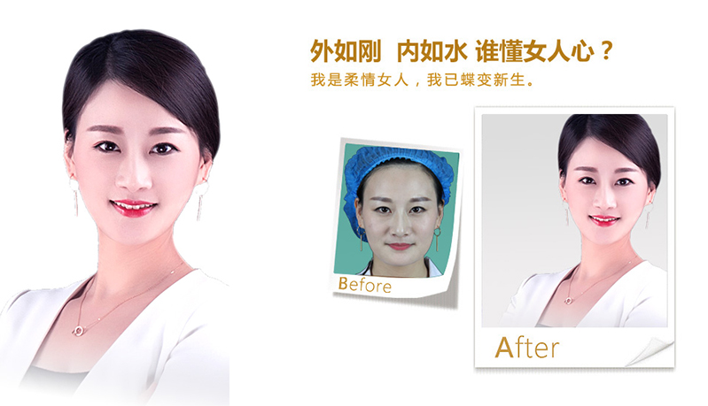 果洛V脸、线雕隆鼻